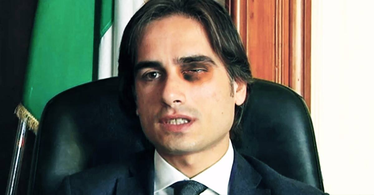 Sindaco Falcomatà con occhio nero, è polemica per la foto "fake" postata dalla deputata Nesci