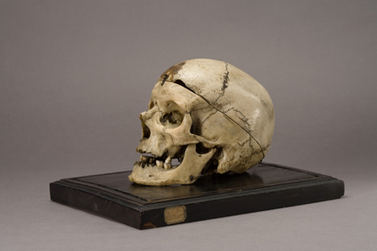 Lamezia: Il Museo Lombroso deve restituire cranio brigante Villella