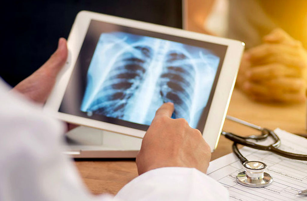 Lamezia, giornata mondiale della tubercolosi: evento scientifico il 12 maggio
