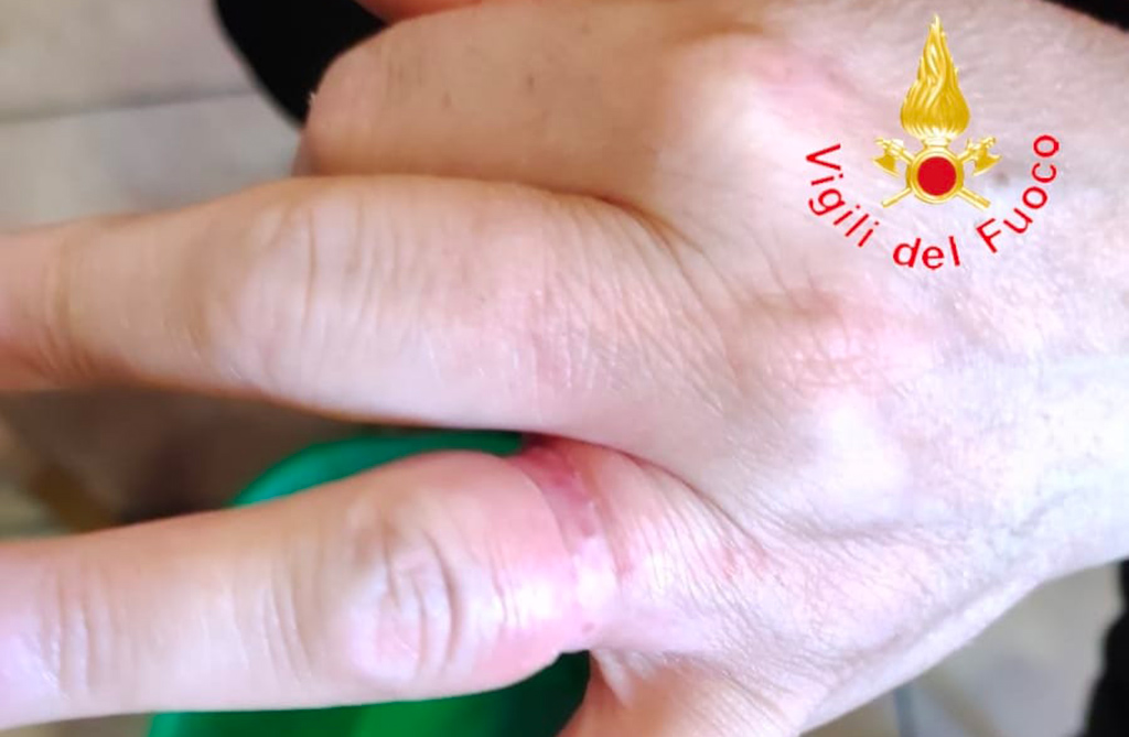 Lamezia, anello incastrato al dito: 58enne aiutata dai Vigili del fuoco 