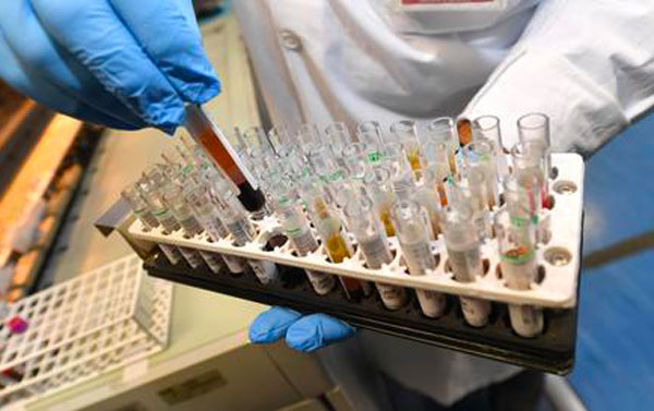 Coronavirus, oltre mille le persone risultate positive in Calabria: 46 più di ieri 