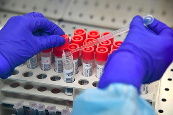 Coronavirus, 13 nuovi casi in Calabria e nessun decesso