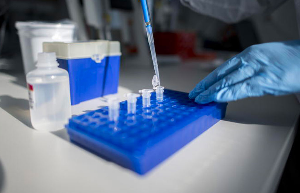 Coronavirus, un solo caso positivo in Calabria: effettuati oltre 120mila tamponi da inizio pandemia