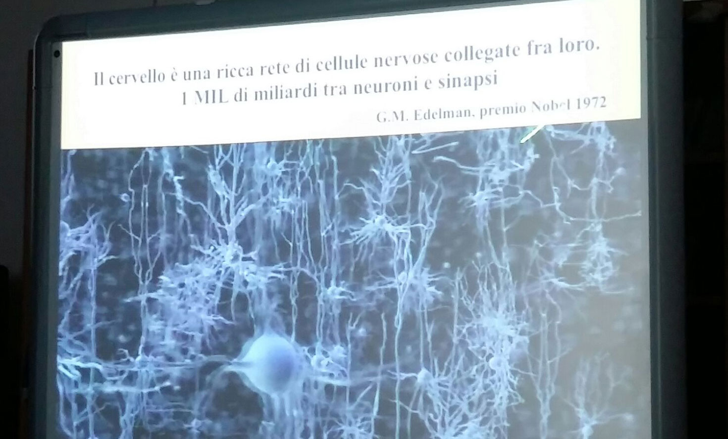cervello.jpg