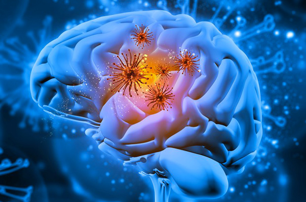 Nuove frontiere per comprendere e contrastare Alzheimer al centro del convegno nazionale dell’AIMAS a Reggio