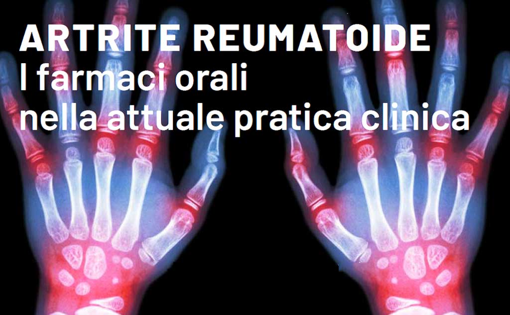 convegno-artrite-reumatoide-lamezia-102019.jpg