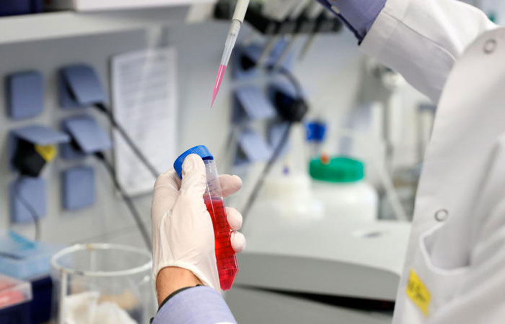 Coronavirus, nessun decesso nelle ultime 24 ore in Calabria e 77 nuovi casi