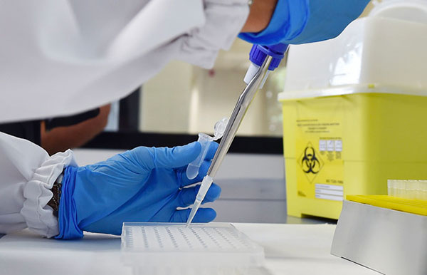 Coronavirus, 234 nuovi contagi in Calabria e 2 decessi 