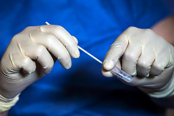 Coronavirus, in Calabria un caso di variante Omicron