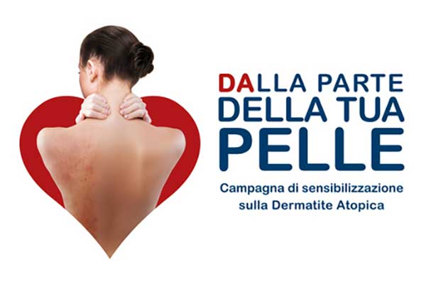 Dermatite atopica, la campagna nazionale "Dalla parte della tua pelle" fa tappa in Calabria il 30 e 31 ottobre