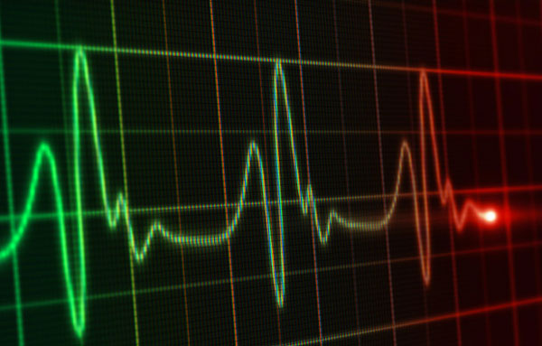 ecg3642b49637f8_82378.jpg