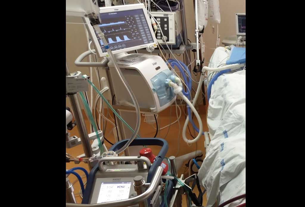 ecmo.jpg