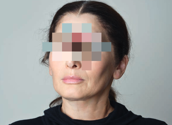 Giornata mondiale della vista, anche in Calabria check up per retinopatia diabetica 