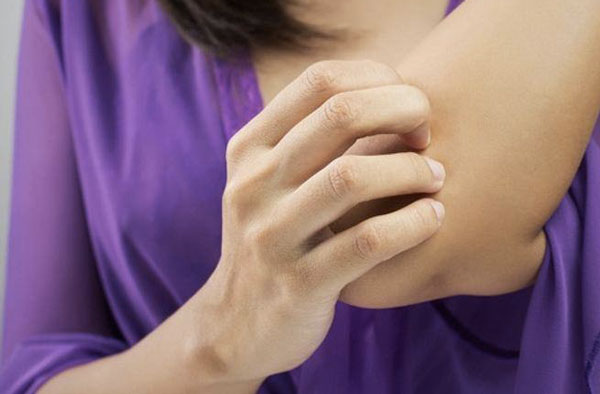 Il 29 ottobre Giornata mondiale per lotta alla psoriasi, controlli anche a Lamezia