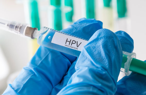 hpv7f9_1af25.jpg