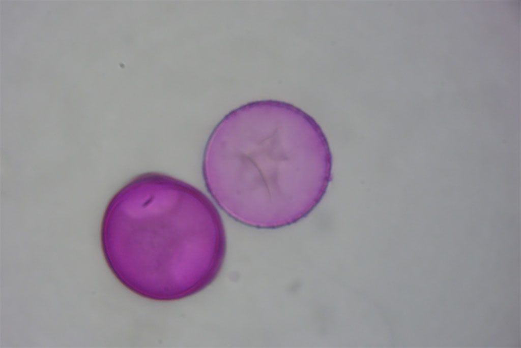 polline-al-microscopio-marzo2024_57151.jpg