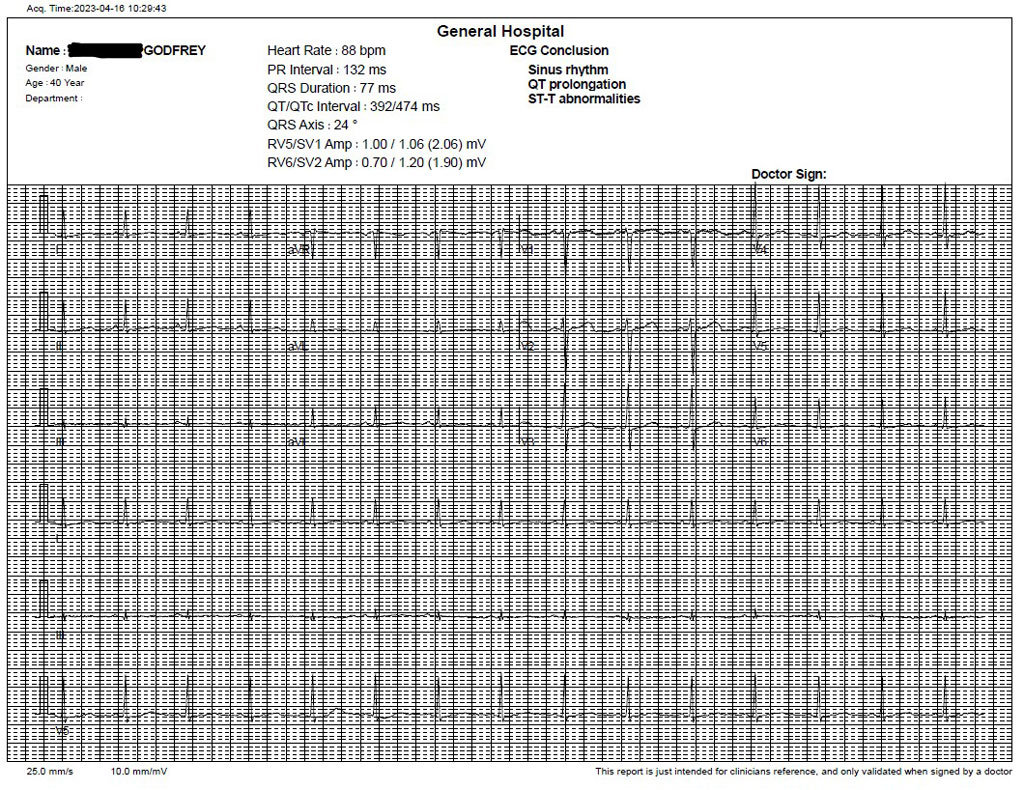 primo-ECG_8a674.jpg