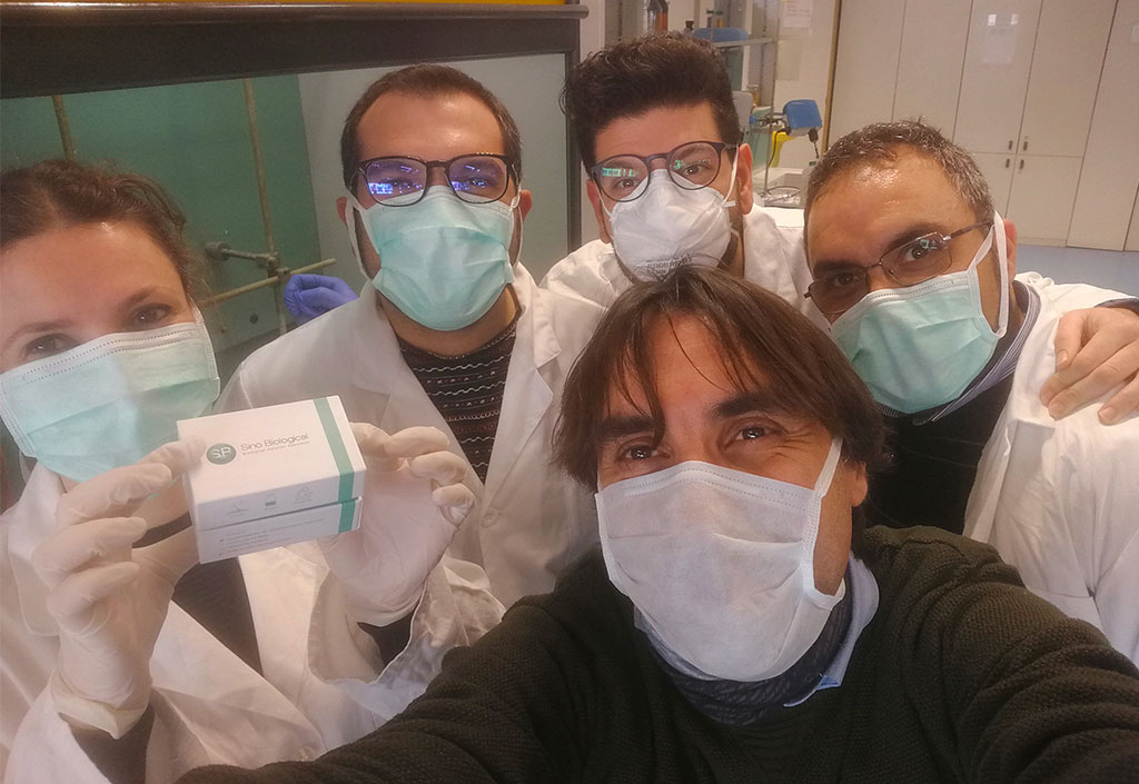 Coronavirus, ricercatori dell'Unical brevettano nuovi anticorpi sintetici: "Potrebbero bloccare l’infezione"