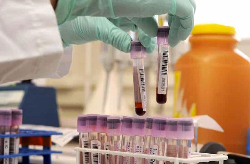 Covid, Regione Calabria aderisce a progetto europeo per raccolta plasma