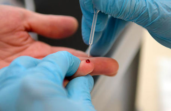 Test sierologici in Italia: prime 7300 chiamate da Croce Rossa, 60% indecisi