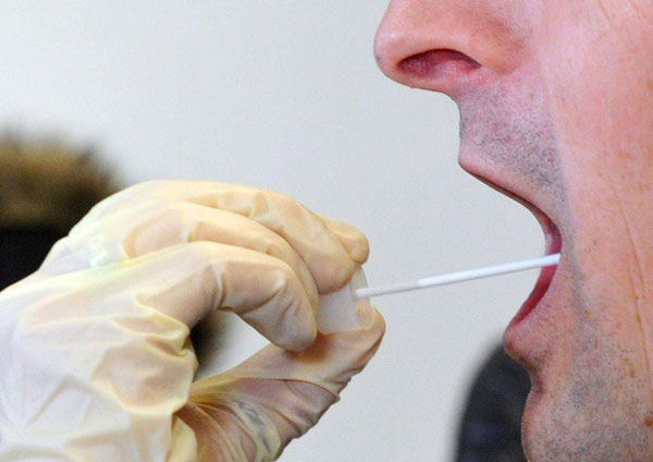 Covid, Anastasi (Iric): “Entro novembre test salivari in 4 ospedali del Reggino”