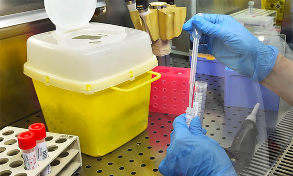 Coronavirus, eseguiti test sierologici su personale del Sant'Anna Hospital a Catanzaro
